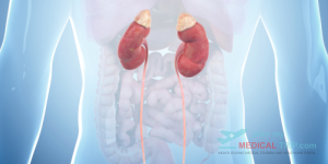 Hysteroscopic Myomectomy