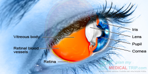 Photodynamic Drug Therapy  - PDT