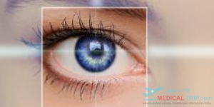 Toric Lens Implant Surgery