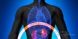 Ureteroneocystostomy - Anti Reflux operations